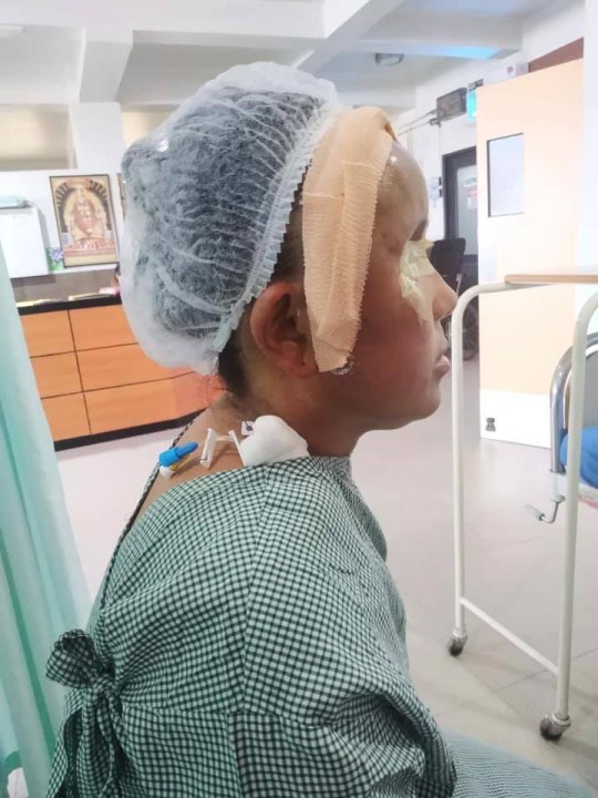 भोजपुरका ब्रेन ट्यूमर पिडितका लागि सहयोग संकलन