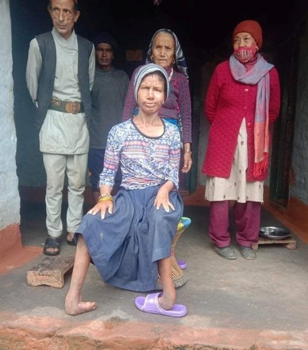 अपांगता भएकी महिलालाई पुर्व बेलायती सेनाको सहयोग