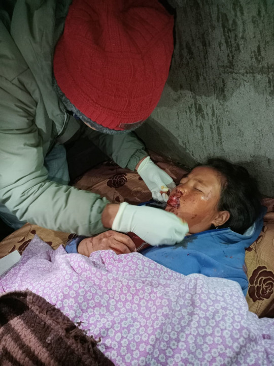 आगलागीबाट बच्न भाग्ने क्रममा घाइते भएकी बालिकाको उपचारमा आर्थिक समस्या, सहयोग जुटाइदै