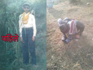 रोगले शरीर कुक्रुक्कः उपचार गरौं, खर्च छैन